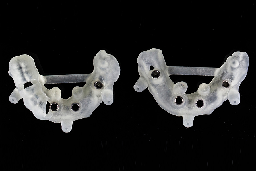 サージカルガイドを使用し、安全な埋入します